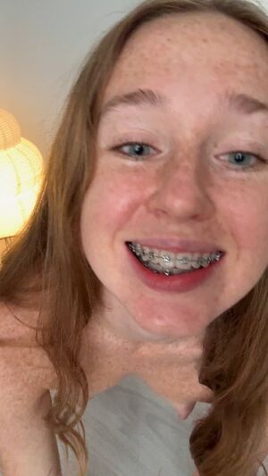 Braceface Braces Freckles Redhead