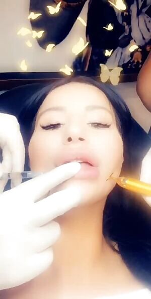 Lauren getting her lips pumped up