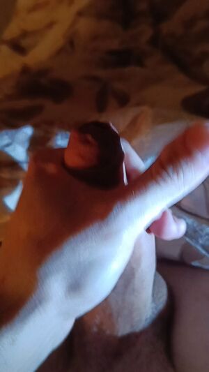 Tight Foreskin (Phimosis) Amateur Cum Femboy