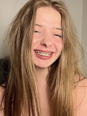 Tiny Tits Braces SnowBunnies Teen Teens