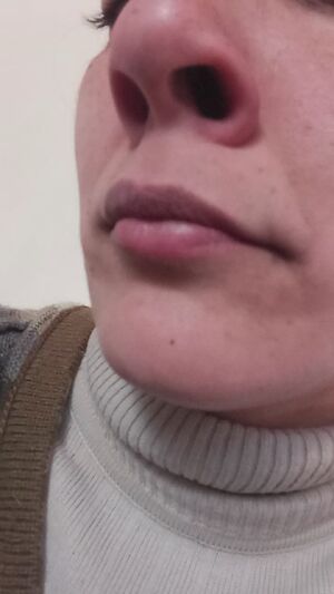 Reddit Creators Amateur Nose OnlyFans