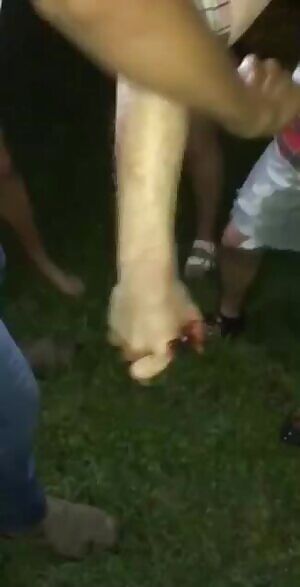 Playing with fireworks aftermath