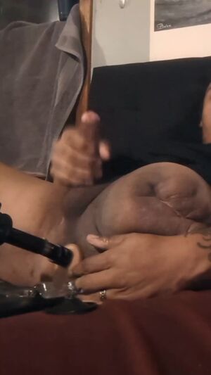 Disability and Sex Amputee Anal Bottom