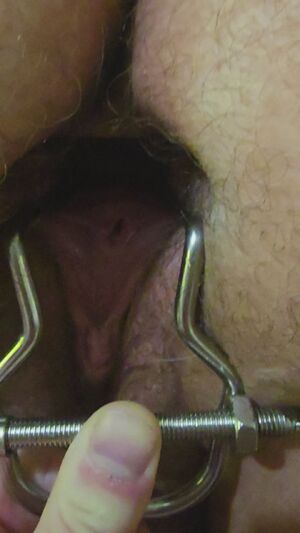 Gaping Anal Speculum BBW Gape Hairy Pussy