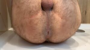 Prolapses Anal Play Asshole Prolapse Rosebud