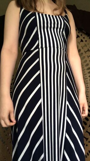 Hairy Girls Dress