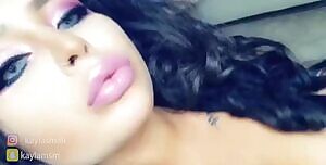 New lip fillers and 800cc implants. How'd I do?