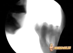 x-ray BJ of Tucker Max