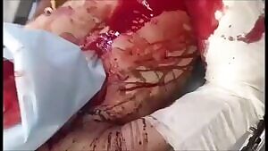 A man who has survived a suicide attempt tries to talk to health professionals